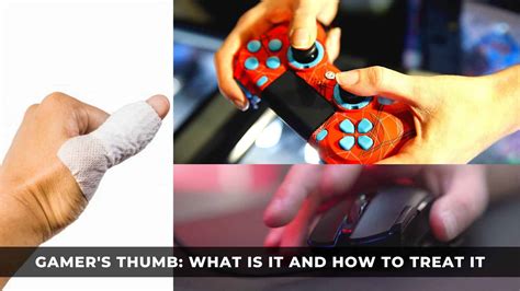 playing card games injury|Gamer’s Thumb and Other Gaming Hand Injuries.